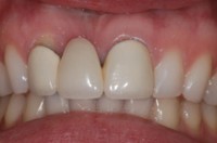 Edward Brant, DDS, MS